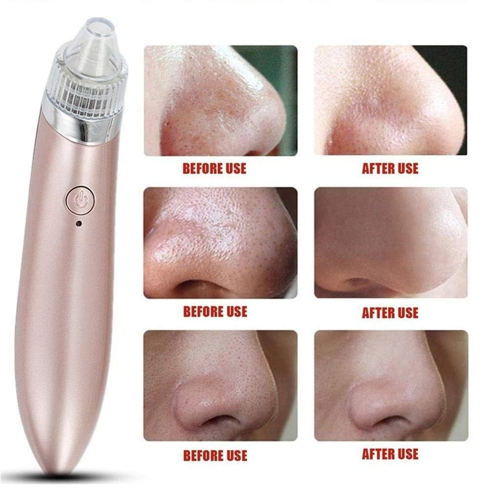 Vacuum Pore Cleaner