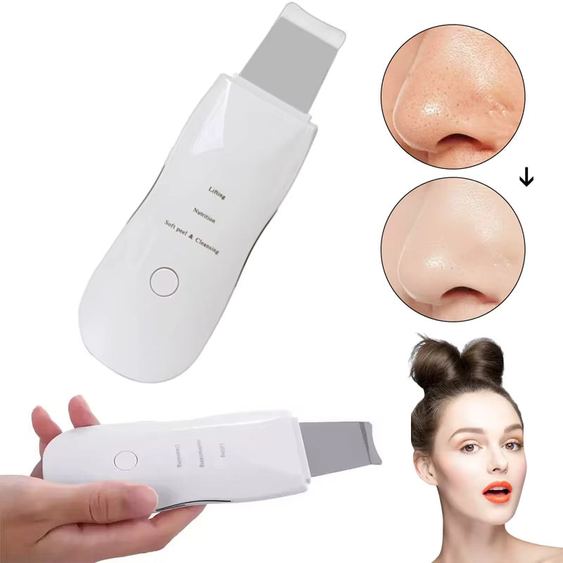 Electric Blackhead Pore Remover
